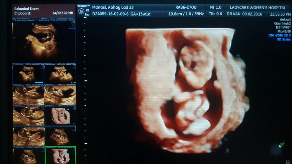 Usa Lady Care Women S Hospital Child Care